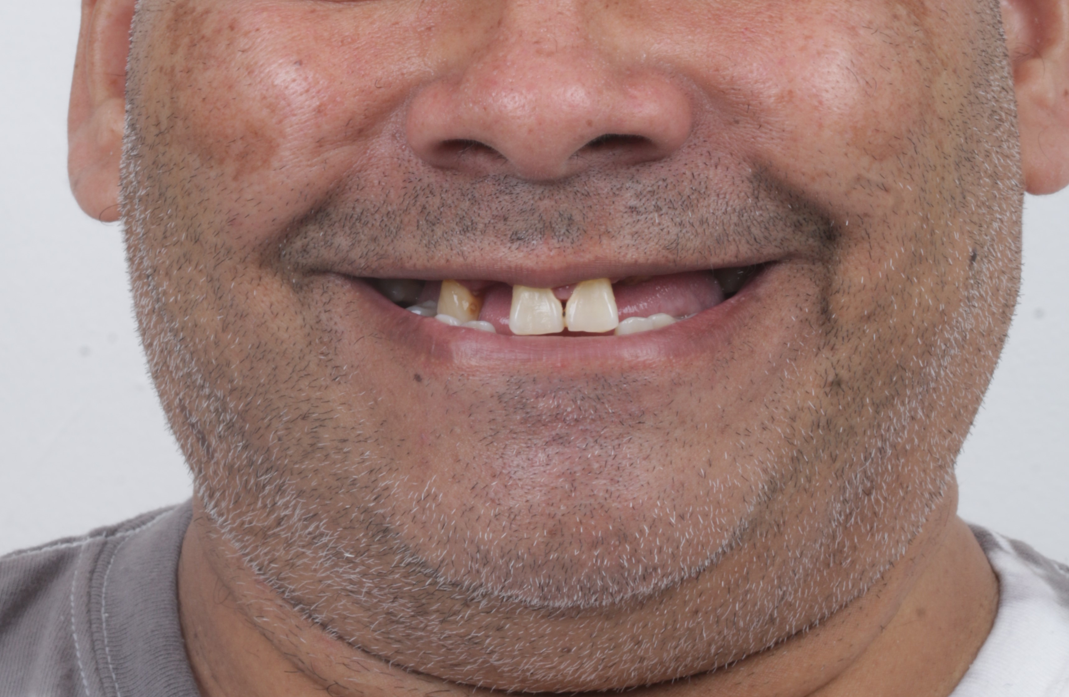 Antes - Luis Santana